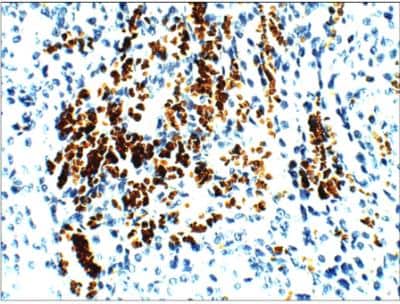 Immunohistochemistry-Paraffin: Aquaporin 1/AQP1 Antibody [NBP3-12257]