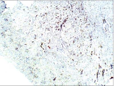 Immunohistochemistry-Paraffin: Aquaporin 1/AQP1 Antibody [NBP3-12257]