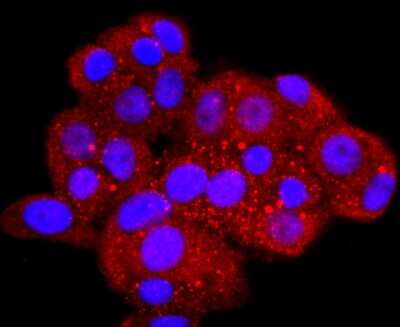 Immunocytochemistry/ Immunofluorescence: Aquaporin 1/AQP1 Antibody (JM10-98) [NBP2-67162]
