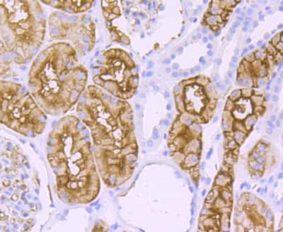 Immunohistochemistry-Paraffin: Aquaporin 1/AQP1 Antibody (JM10-98) [NBP2-67162]