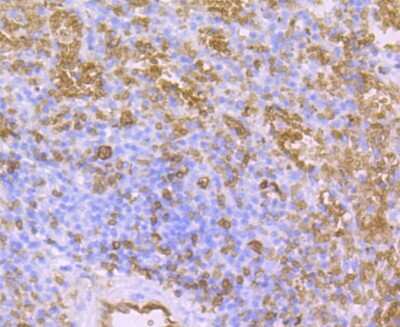 Immunohistochemistry-Paraffin: Aquaporin 1/AQP1 Antibody (JM10-98) [NBP2-67162]