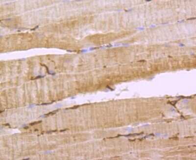 Immunohistochemistry-Paraffin: Aquaporin 1/AQP1 Antibody (JM10-98) [NBP2-67162]