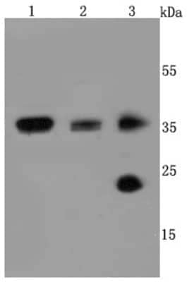 Western Blot: Aquaporin 1/AQP1 Antibody (JM10-98) [NBP2-67162]