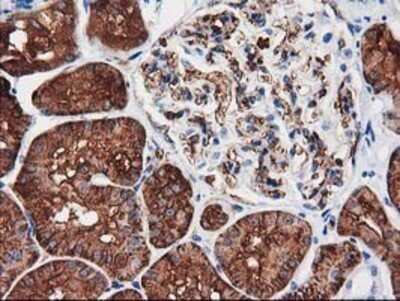 Immunohistochemistry: Aquaporin 1/AQP1 Antibody (OTI2D10) - Azide and BSA Free [NBP2-70199]