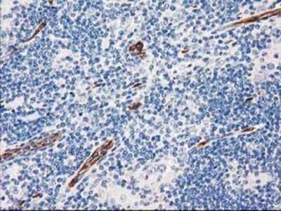 Immunohistochemistry: Aquaporin 1/AQP1 Antibody (OTI2D10) - Azide and BSA Free [NBP2-70199]