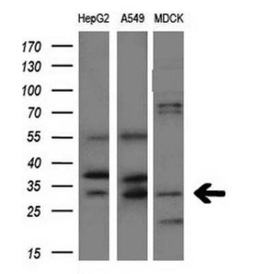 Western Blot: Aquaporin 1/AQP1 Antibody (OTI2D10)Azide and BSA Free [NBP2-70199]