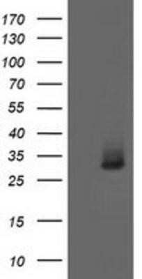 Western Blot: Aquaporin 1/AQP1 Antibody (OTI2D10)Azide and BSA Free [NBP2-70199]