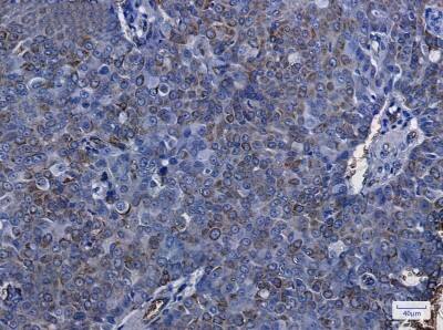 Immunohistochemistry-Paraffin: Aquaporin 1/AQP1 Antibody (S03-7G5) [NBP3-19572]
