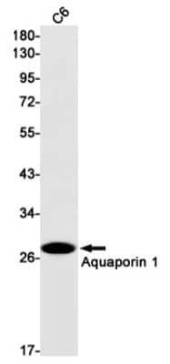 Western Blot: Aquaporin 1/AQP1 Antibody (S03-7G5) [NBP3-19572]