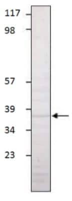 Western Blot: Aquaporin 1/AQP1 Antibody [NBP3-12257]