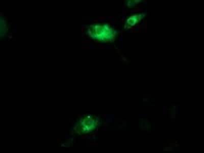 Immunocytochemistry/ Immunofluorescence: Aquaporin 1/AQP1 Antibody (OTI2D10) [NBP2-03568]