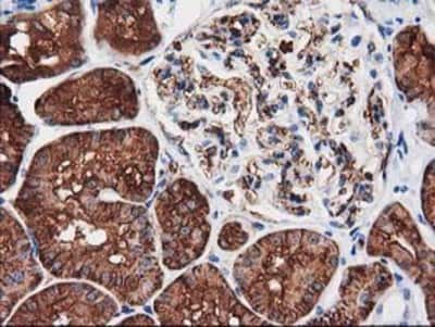 Immunohistochemistry-Paraffin: Aquaporin 1/AQP1 Antibody (OTI2D10) [NBP2-03568]