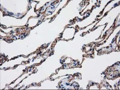 Immunohistochemistry-Paraffin: Aquaporin 1/AQP1 Antibody (OTI2D10) [NBP2-03568]