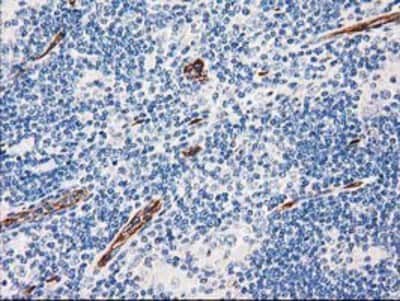 Immunohistochemistry-Paraffin: Aquaporin 1/AQP1 Antibody (OTI2D10) [NBP2-03568]