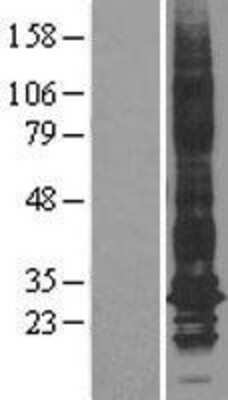 Western Blot: Aquaporin 1/AQP1 Overexpression Lysate [NBL1-07635]