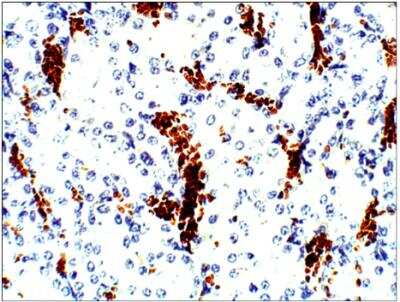 Immunohistochemistry-Paraffin: Aquaporin-10 Antibody [NBP3-12258]