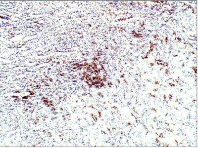 Immunohistochemistry-Paraffin: Aquaporin-10 Antibody [NBP3-12258]