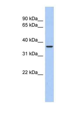 Western Blot: Aquaporin-10 Antibody [NBP1-62621]