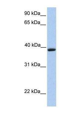 Western Blot: Aquaporin-10 Antibody [NBP1-69625]