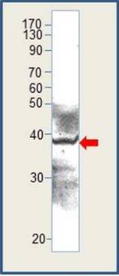 Western Blot: Aquaporin-10 Antibody [NBP3-12258]