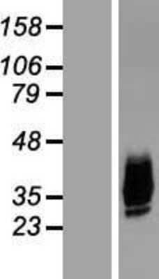 Western Blot: Aquaporin-10 Overexpression Lysate [NBL1-07636]