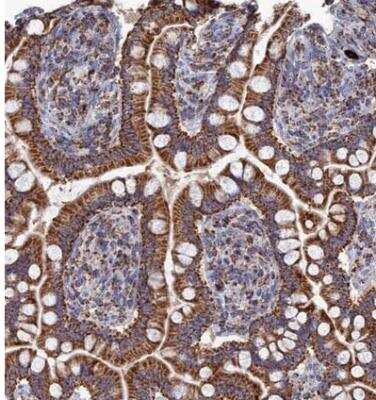 Immunohistochemistry-Paraffin: Aquaporin-11 Antibody [NBP1-86208]