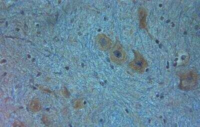 Immunohistochemistry-Paraffin: Aquaporin-11 Antibody [NBP2-80500]