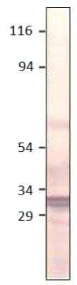 Western Blot: Aquaporin-11 Antibody [NBP3-12234]