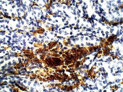 Immunohistochemistry-Paraffin: Aquaporin-12A Antibody [NBP3-12278]