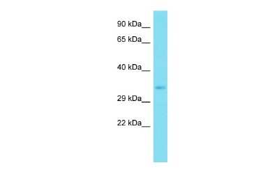 Western Blot: Aquaporin-12A Antibody [NBP2-82651]