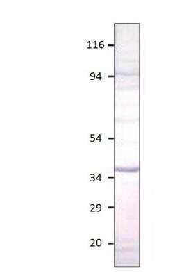 Western Blot: Aquaporin-12A Antibody [NBP3-12278]