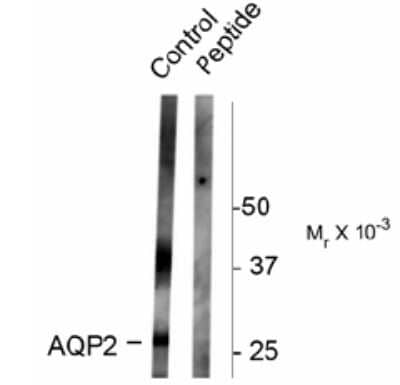 Western Blot: Aquaporin-2 [p Ser261] Antibody [NB100-61100]