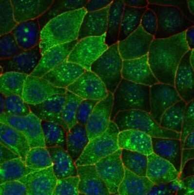 Immunocytochemistry/ Immunofluorescence: Aquaporin-2 Antibody - BSA Free [NB110-74682]