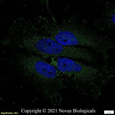 Immunocytochemistry/ Immunofluorescence: Aquaporin-2 Antibody - BSA Free [NB110-74682]