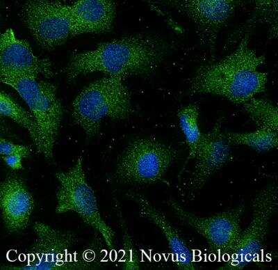 Immunocytochemistry/ Immunofluorescence: Aquaporin-2 Antibody - BSA Free [NB110-74682]