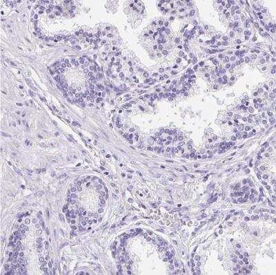 Immunohistochemistry-Paraffin: Aquaporin-2 Antibody [NBP2-33472]