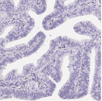 Immunohistochemistry-Paraffin: Aquaporin-2 Antibody [NBP2-33472]