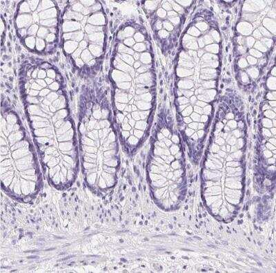 Immunohistochemistry-Paraffin: Aquaporin-2 Antibody [NBP2-33472]