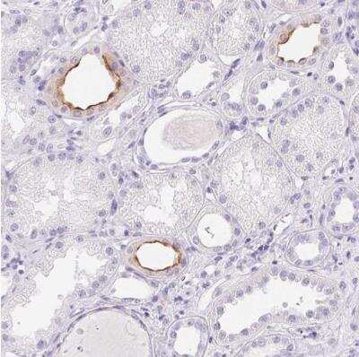 Immunohistochemistry-Paraffin: Aquaporin-2 Antibody [NBP2-33472]