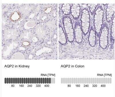 Immunohistochemistry-Paraffin: Aquaporin-2 Antibody [NBP2-33472]