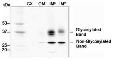 Western Blot: Aquaporin-2 AntibodyBSA Free [NB110-74682]