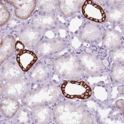 Immunohistochemistry-Paraffin: Aquaporin-3 Antibody [NBP2-33872]