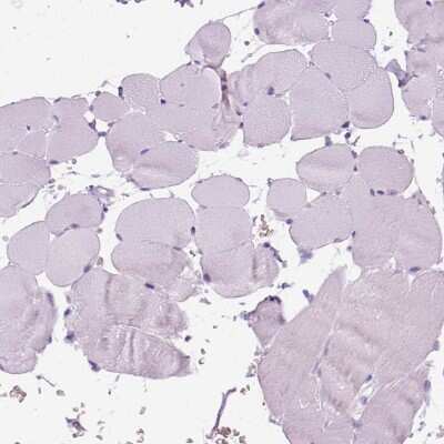 Immunohistochemistry-Paraffin: Aquaporin-3 Antibody [NBP2-33872]