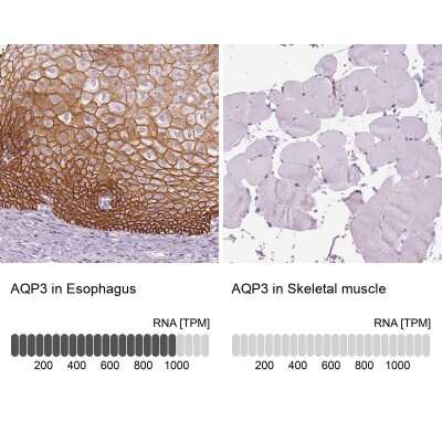 Immunohistochemistry-Paraffin: Aquaporin-3 Antibody [NBP2-33872]