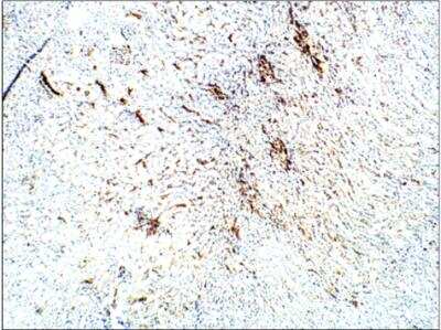 Immunohistochemistry-Paraffin: Aquaporin-3 Antibody [NBP3-12259]