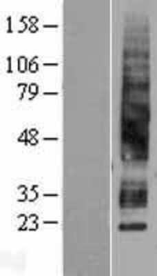 Western Blot: Aquaporin-3 Overexpression Lysate [NBL1-07638]