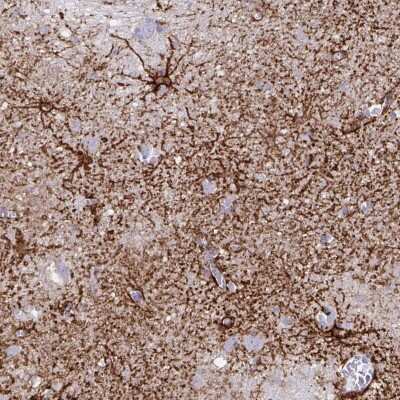 Immunohistochemistry-Paraffin: Aquaporin-4 Antibody (CL0178) [NBP2-52872]