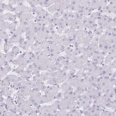 Immunohistochemistry-Paraffin: Aquaporin-4 Antibody (CL0178) [NBP2-52872]