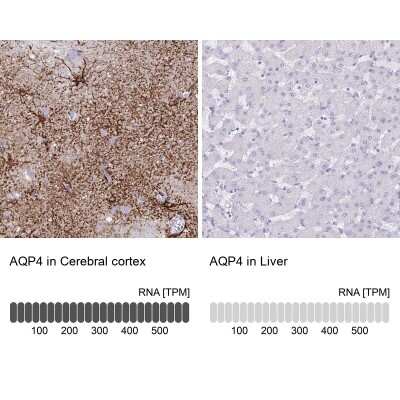 Immunohistochemistry-Paraffin: Aquaporin-4 Antibody (CL0178) [NBP2-52872]