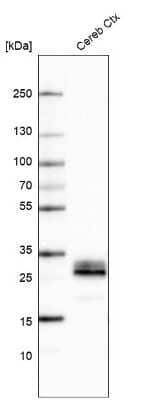 Western Blot: Aquaporin-4 Antibody (CL0178) [NBP2-52872]